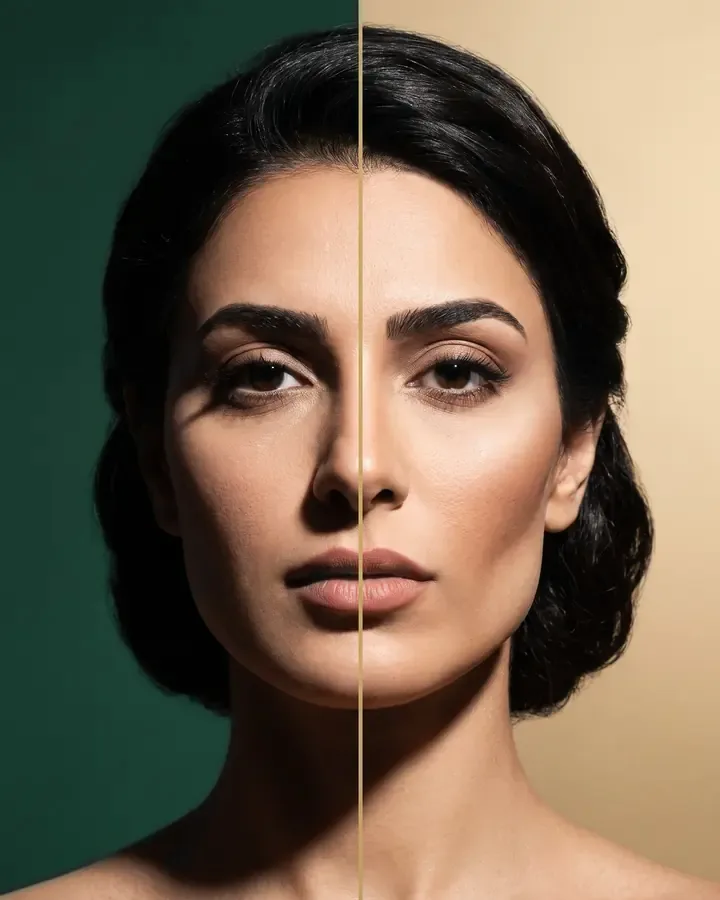 فيلر الخدين · نحت الوجه