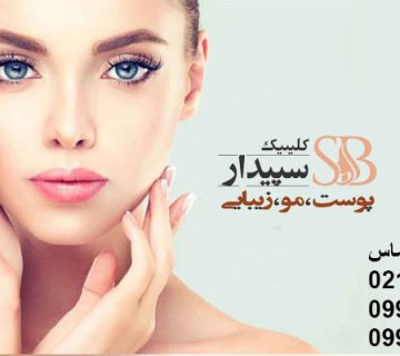 لیزر موهای زائد