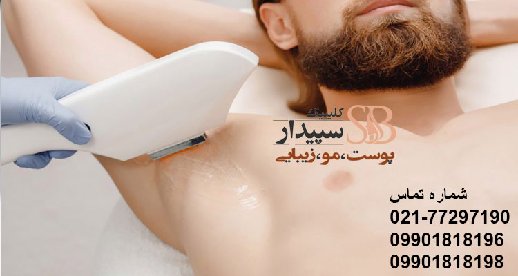 لیزر زیر بغل