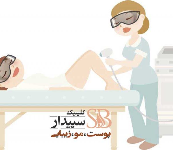 لیزر بیکینی