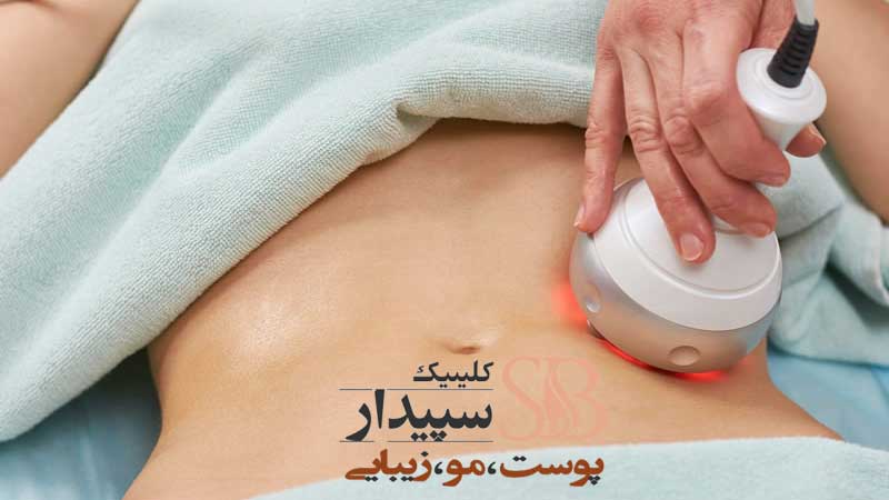 لاغری با دستگاه RF