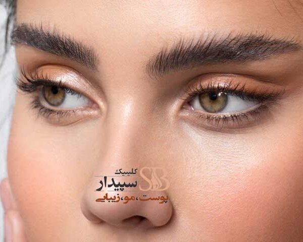 لیفت چشم گربه ای