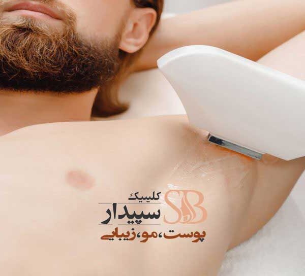 لیزر زیر بغل