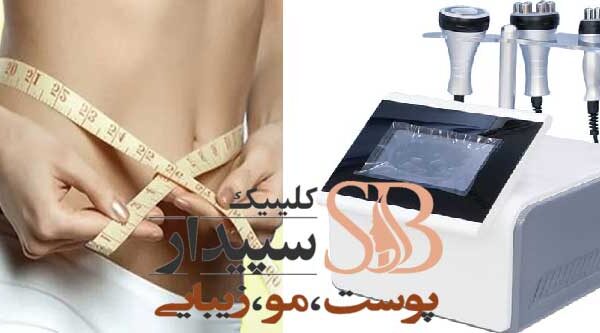 لاغری با دستگاه کویتیشن