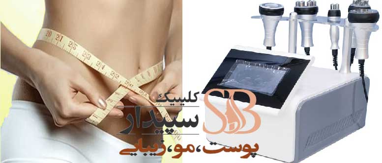 لاغری با دستگاه کویتیشن