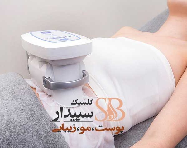  لاغری موضعی با کرایولیپولیز شرق تهران