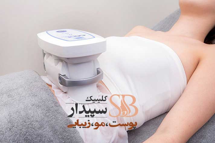  لاغری موضعی با کرایولیپولیز شرق تهران