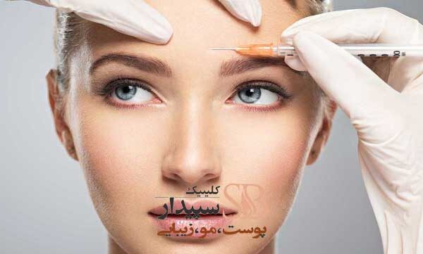 بوتاکس خط اخم