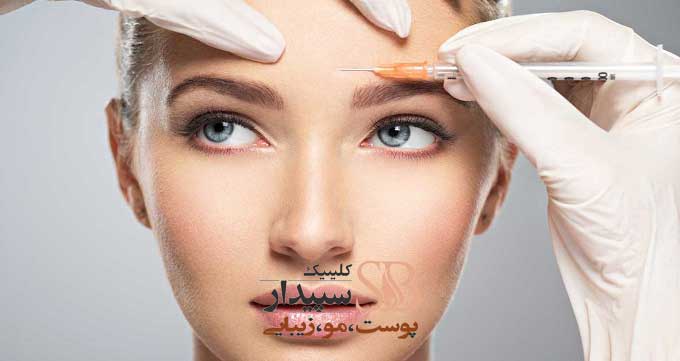 بوتاکس خط اخم