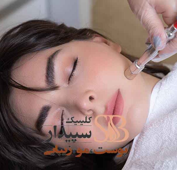 میکرودرم صورت