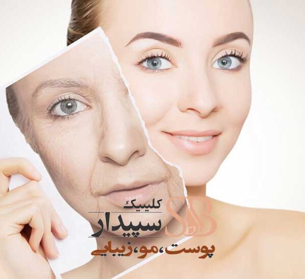 لیزر جوانسازی پوست