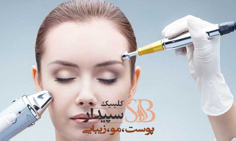 لیزر پوست صورت