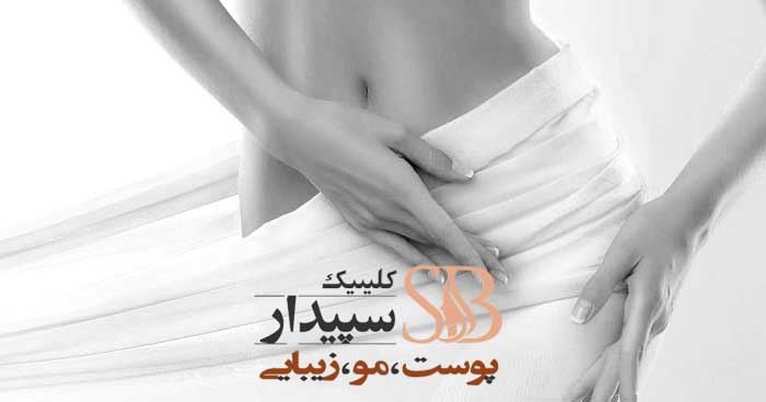 لیزر موهای زائد بیکینی شرق تهران