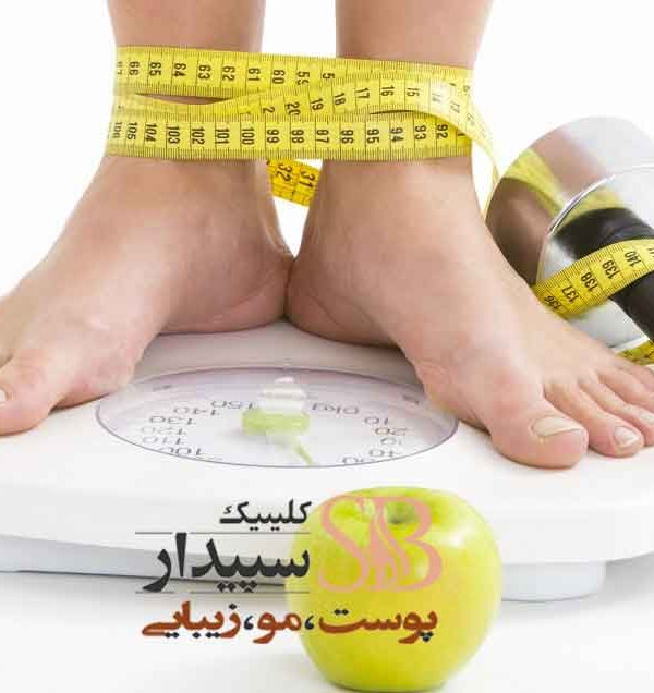 مزایای آنالیز وزن و چربی شرق تهران
