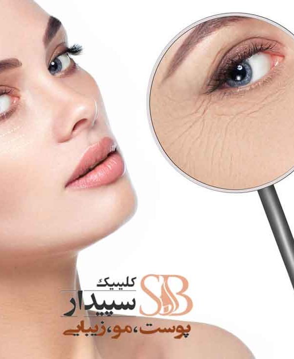 کربوکسی تراپی تهرنپارس