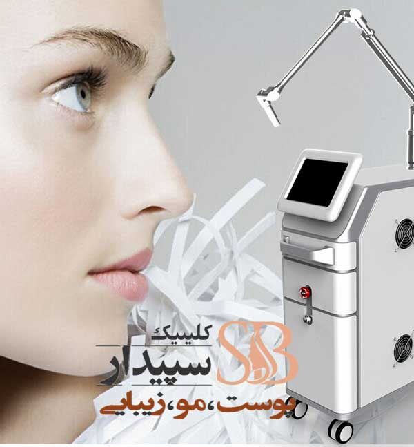 لیزر کیوسوئیچ شرق تهران