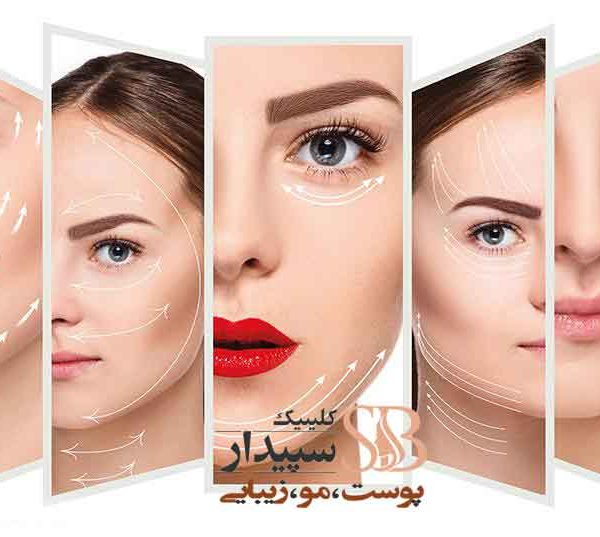 لیفت صورت با نخ تهرانپارس