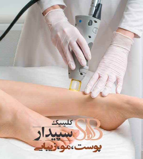 لیزر موهای زائد شرق تهران