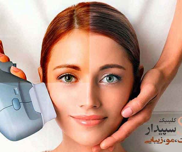 جوانسازی با هایفو تهرانپارس