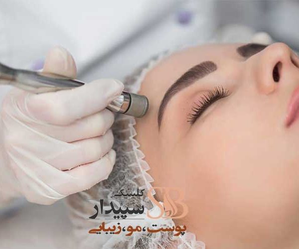 میکرودرم شرق تهران