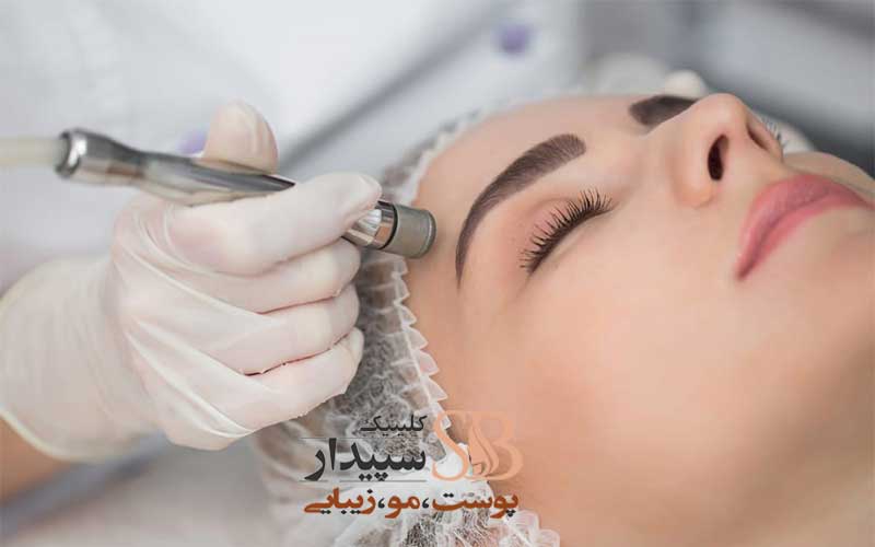 میکرودرم شرق تهران