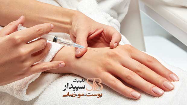بهترین مرکز تزریق ژل وجوانسازی پوست دست