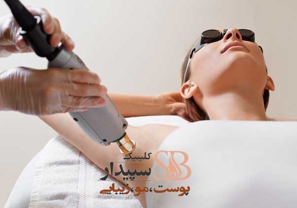 لیزر زیر بغل شرق تهران