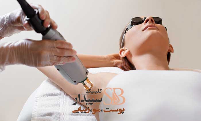 لیزر زیر بغل شرق تهران
