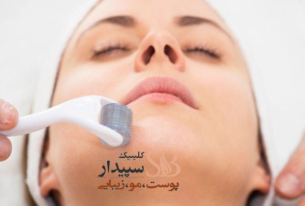 بهترین مرکز میکرونیدلینگ شرق تهران