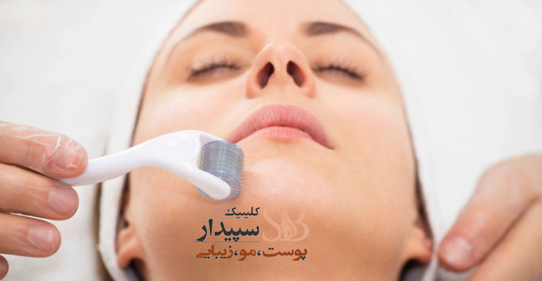 بهترین مرکز میکرونیدلینگ شرق تهران