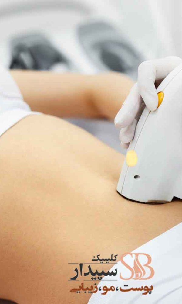 لیزر شکم و کمر تهرانپارس