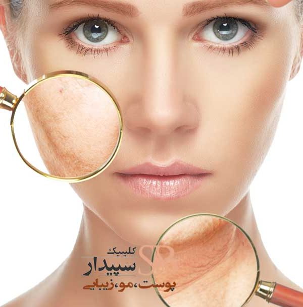 جوانسازی پوست و انواع مشکلات پوستی