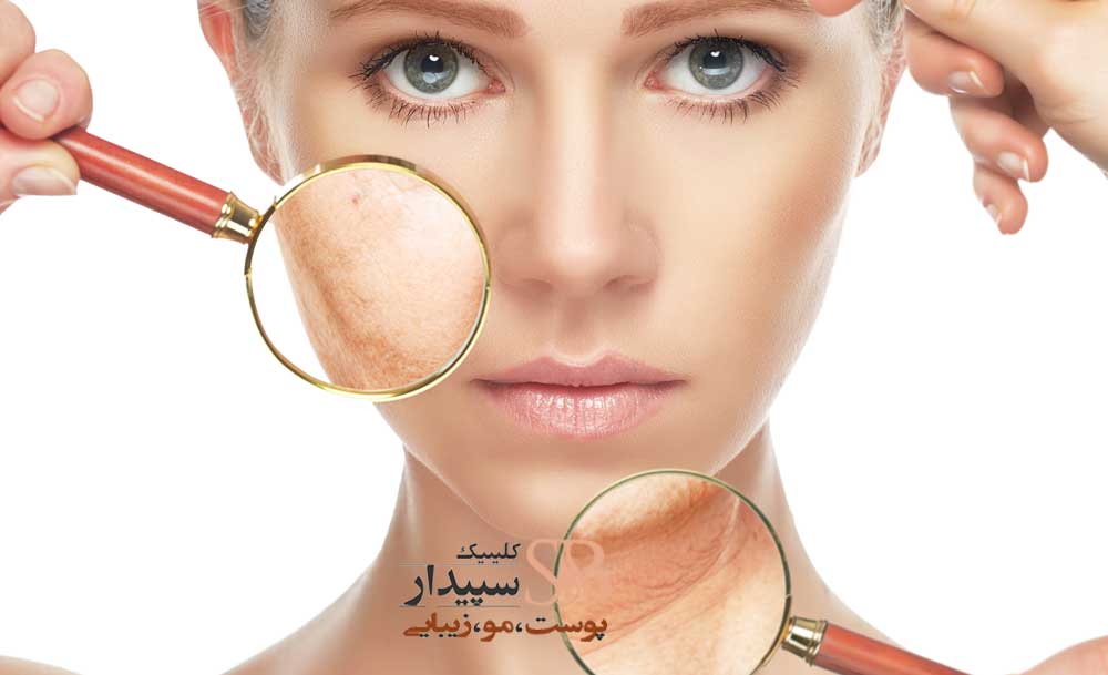 جوانسازی پوست و انواع مشکلات پوستی