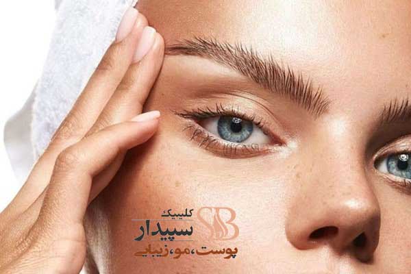 جوانسازی و لیفت ابرو با نخ