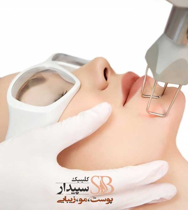 جوانسازی پوست با لیز CO2 فرکشنال