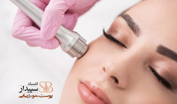 جوانسازی پوست با میکرودرم ابریژن