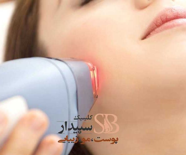 لیزر موهای زائد تهرانپارس
