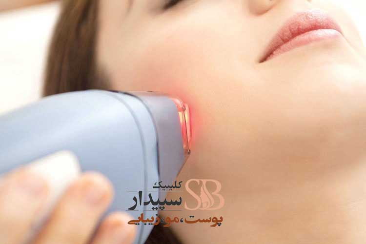 لیزر موهای زائد تهرانپارس
