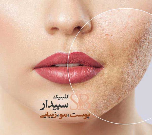 سابسیژن شرق تهران (سابسیژن تهرانپارس)