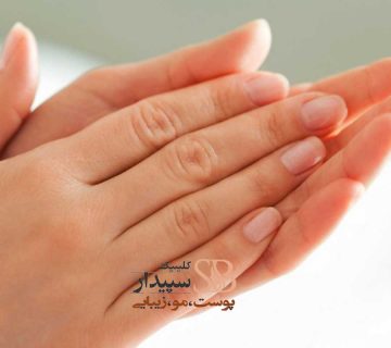 جوانسازی پوست دست با هایفو