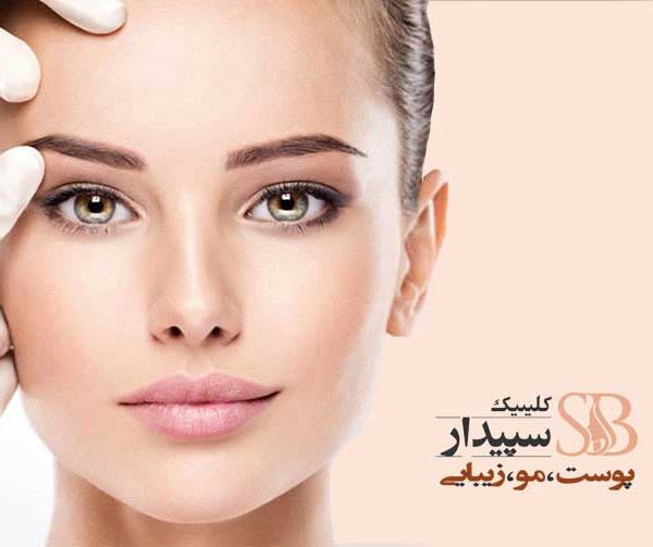 لیفت شقیقه با پلاسما جت