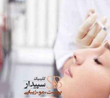 بوتاکس مصپورت