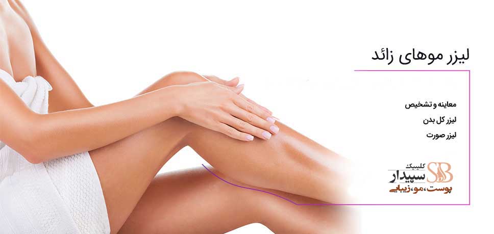 لیزر موهای زائد