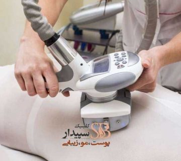 لاغری با دستگاه کویتیشن