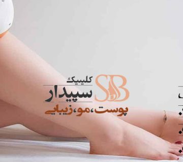 لیزر موهای زائد پا