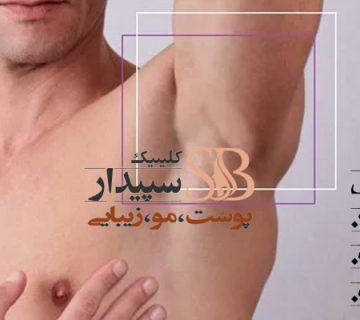 قیمت لیزر موهای زائد