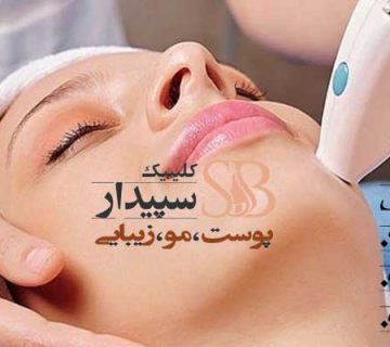 لیزر موهای زائد