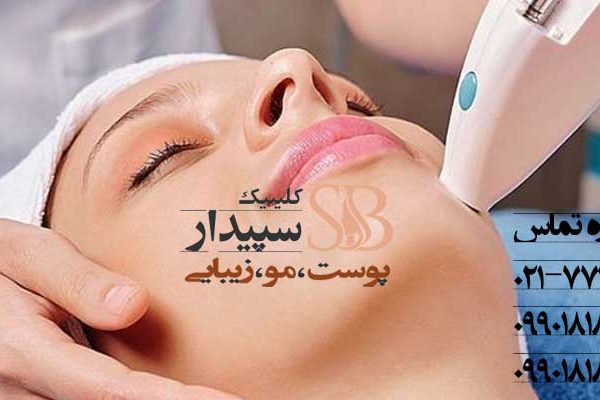 لیزر موهای زائد