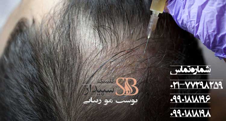 اگزوسرم؛ سلول درمانی پوست و مو